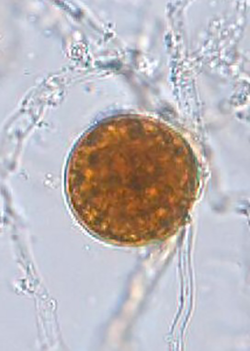   Phytophthora fragariaefolia  (ex-type CH05NSU11) asexual phase: spherical intercalary chlamydospore; photonbsp;by Mohamed Rahman and Koji Kageyama, Gifu University, Japan. 
